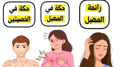 أسباب الحكة في الجسم والمناطق الحساسة والرأس والثدي